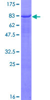 ab158647 on a 12.5% SDS-PAGE stained with Coomassie Blue.