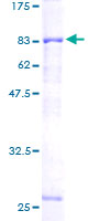 ab160620 on a 12.5% SDS-PAGE stained with Coomassie Blue.
