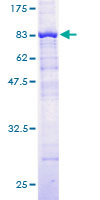 ab160621 on a 12.5% SDS-PAGE stained with Coomassie Blue.