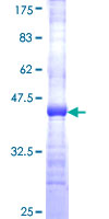 ab160622 on a 12.5% SDS-PAGE stained with Coomassie Blue.