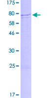 ab166518 on a 12.5% SDS-PAGE stained with Coomassie Blue.