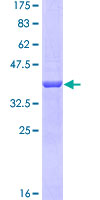 ab162321 on a 12.5% SDS-PAGE stained with Coomassie Blue.