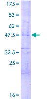 ab163655 on a 12.5% SDS-PAGE stained with Coomassie Blue.