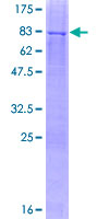 ab166156 on a 12.5% SDS-PAGE stained with Coomassie Blue.