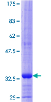 ab158652 on a 12.5% SDS-PAGE stained with Coomassie Blue.