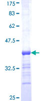 ab152956 on a 12.5% SDS-PAGE stained with Coomassie Blue.