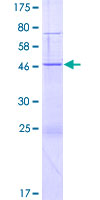 ab165416 on a 12.5% SDS-PAGE stained with Coomassie Blue.