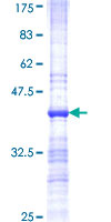 ab153485 on a 12.5% SDS-PAGE stained with Coomassie Blue.