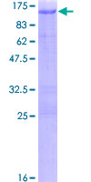 ab157907 on a 12.5% SDS-PAGE stained with Coomassie Blue.