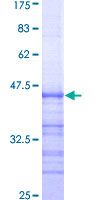 ab157908 on a 12.5% SDS-PAGE stained with Coomassie Blue.