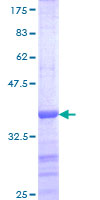 ab165908 on a 12.5% SDS-PAGE stained with Coomassie Blue.