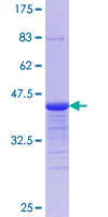ab153300 on a 12.5% SDS-PAGE stained with Coomassie Blue.