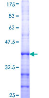ab160827 on a 12.5% SDS-PAGE stained with Coomassie Blue.