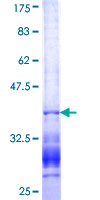 ab160828 on a 12.5% SDS-PAGE stained with Coomassie Blue.