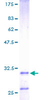 ab158710 on a 12.5% SDS-PAGE stained with Coomassie Blue.