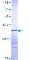 ab159926 on a 12.5% SDS-PAGE stained with Coomassie Blue.