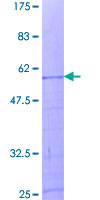 ab158630 on a 12.5% SDS-PAGE stained with Coomassie Blue.