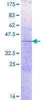 ab159994 on a 12.5% SDS-PAGE stained with Coomassie Blue.