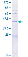 ab159996 on a 12.5% SDS-PAGE stained with Coomassie Blue.