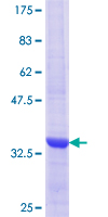 ab159997 on a 12.5% SDS-PAGE stained with Coomassie Blue.