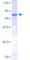 ab164218 on a 12.5% SDS-PAGE stained with Coomassie Blue.