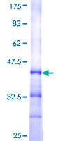 ab164219 on a 12.5% SDS-PAGE stained with Coomassie Blue.