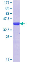 ab166180 on a 12.5% SDS-PAGE stained with Coomassie Blue.