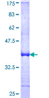 ab158655 on a 12.5% SDS-PAGE stained with Coomassie Blue.