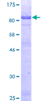 ab158662 on a 12.5% SDS-PAGE stained with Coomassie Blue.
