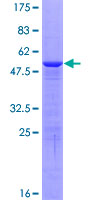 ab158663 on a 12.5% SDS-PAGE stained with Coomassie Blue.