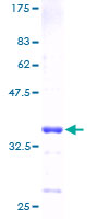 ab160428 on a 12.5% SDS-PAGE stained with Coomassie Blue.