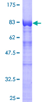 ab153089 on a 12.5% SDS-PAGE stained with Coomassie Blue.