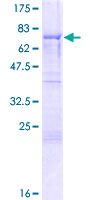 ab153090 on a 12.5% SDS-PAGE stained with Coomassie Blue.
