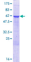 ab158664 on a 12.5% SDS-PAGE stained with Coomassie Blue.