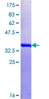 ab160746 on a 12.5% SDS-PAGE stained with Coomassie Blue.