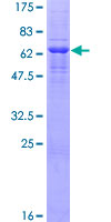 ab162376 on a 12.5% SDS-PAGE stained with Coomassie Blue.