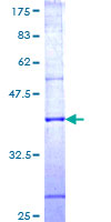 ab162377 on a 12.5% SDS-PAGE stained with Coomassie Blue.