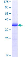 ab158684 on a 12.5% SDS-PAGE stained with Coomassie Blue.
