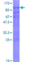 ab163599 on a 12.5% SDS-PAGE stained with Coomassie Blue.