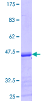 ab163600 on a 12.5% SDS-PAGE stained with Coomassie Blue.