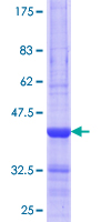ab164585 on a 12.5% SDS-PAGE stained with Coomassie Blue.