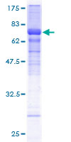 ab162259 on a 12.5% SDS-PAGE stained with Coomassie Blue.