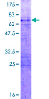 ab158672 on a 12.5% SDS-PAGE stained with Coomassie Blue.