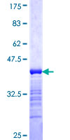 ab158673 on a 12.5% SDS-PAGE stained with Coomassie Blue.