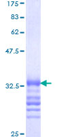 ab158666 on a 12.5% SDS-PAGE stained with Coomassie Blue.