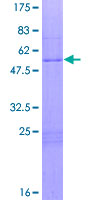 ab158668 on a 12.5% SDS-PAGE stained with Coomassie Blue.