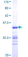ab158669 on a 12.5% SDS-PAGE stained with Coomassie Blue.