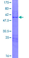 ab158670 on a 12.5% SDS-PAGE stained with Coomassie Blue.
