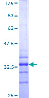 ab158671 on a 12.5% SDS-PAGE stained with Coomassie Blue.