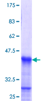 ab158676 on a 12.5% SDS-PAGE stained with Coomassie Blue.